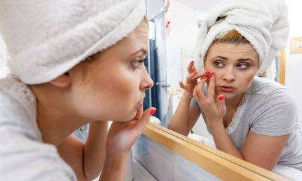 The Awful, Horrible, Disaster Called Acne: YUCK!